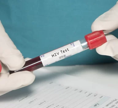 HIV and STD Testing Singapore – Know Where To Take HIV And STD Test In Singapore