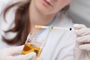 How to Use Synthetic Urine Kits to Get the Perfect Pee Sample?