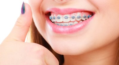 Questions about Orthodontic Treatment