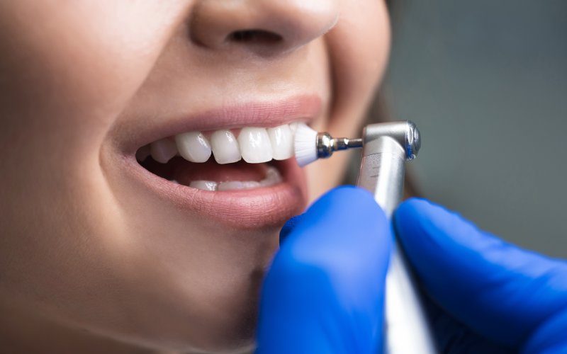 Maintain A Proper Oral Hygiene With Dental Crown Cleaning