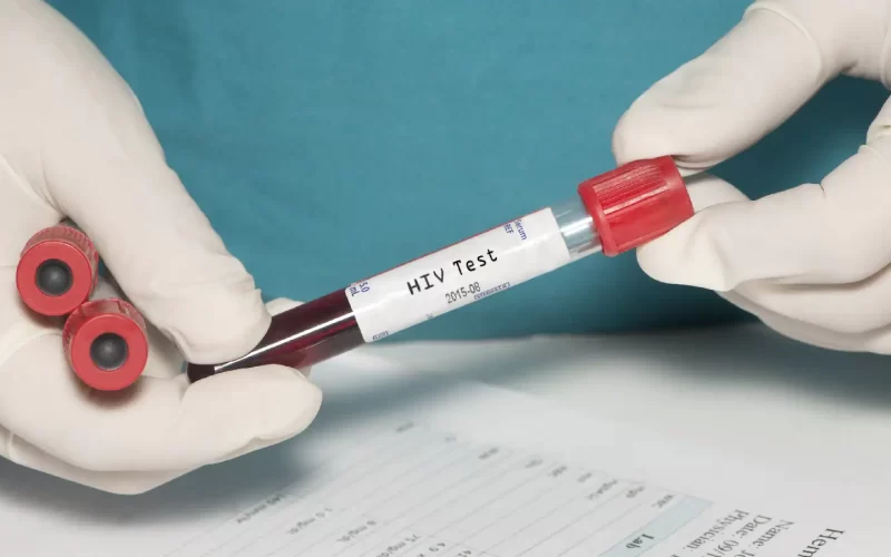 HIV and STD Testing Singapore – Know Where To Take HIV And STD Test In Singapore